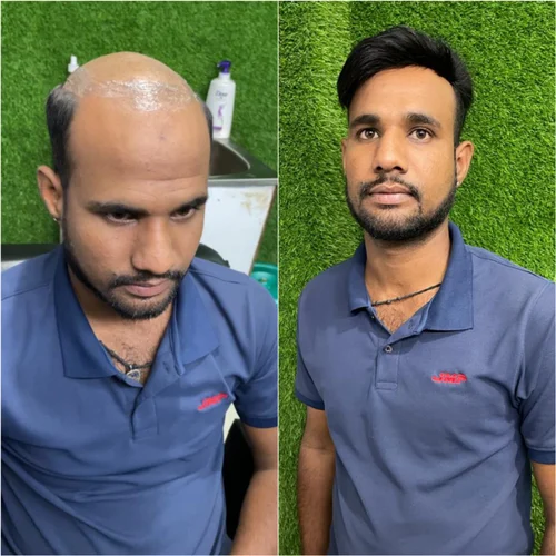 hair pasting service 500x500